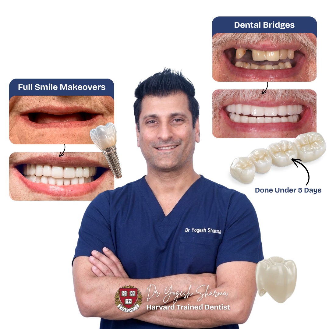 Dr Yogesh Sharma — Harvard Trained Dentist, smile makeover and dental bridges results